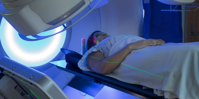 Introducing AXREM’s Radiotherapy Video:  A Compassionate Guide for Patients