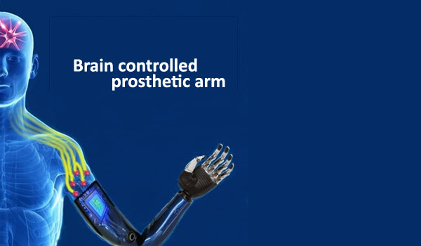 Why Prostheses are a Life Changing Tool